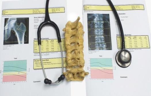 Obstructive Sleep Apnea Tied to Weaker Bones and Teeth in Adults