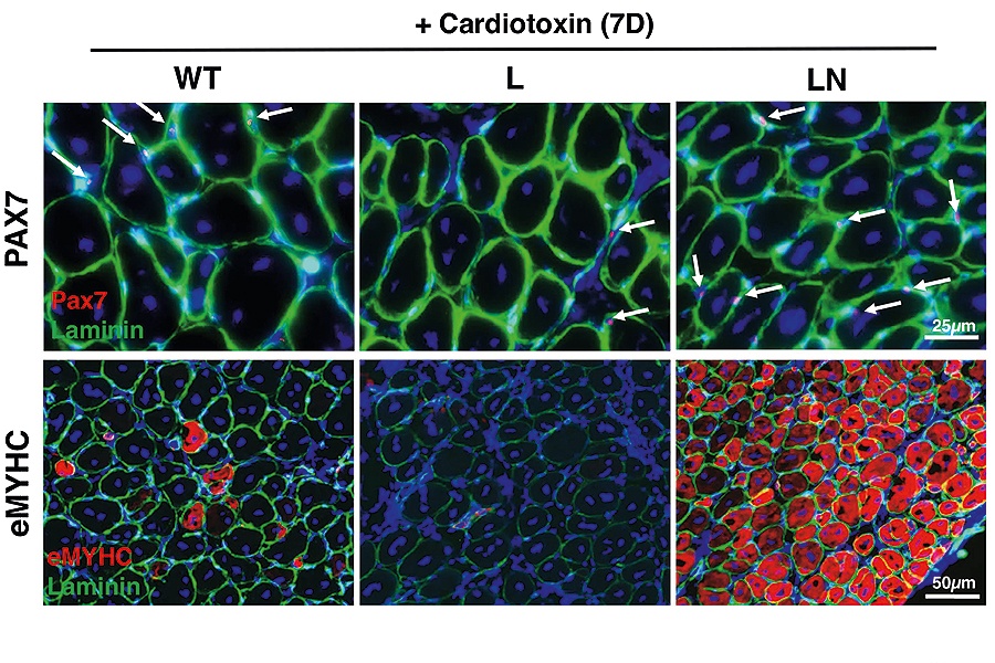"To reverse aging in stem cells, NANOG gene ‘rewires’ metabolic networks; The image, above, shows NANOG restoring skeletal muscle regeneration in mouse models. The red in the top three panels is the protein PAX7, and red in the bottom three panels is eMyHC (embryonic myosin heavy chain). The green in all panels in laminin, and the blue in all panels in cell nuclei. Credit: University at Buffalo."