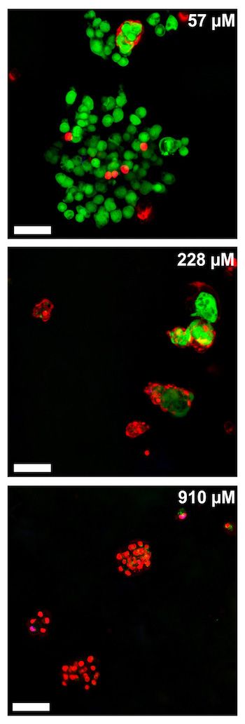 cancer cell images