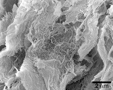 electron microscopy image