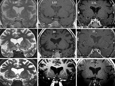 MRI image of Reem Itani's brain