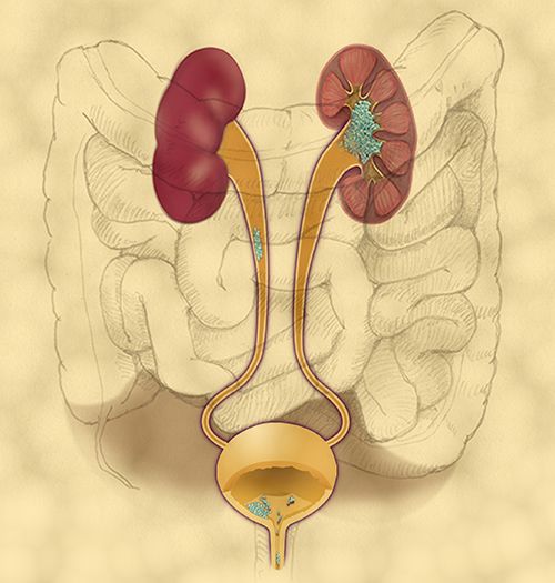 Illustration of the bladder and upper urinary tract 