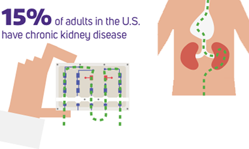 kidney on a chip infographic