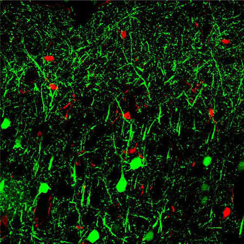 MicroRNA 142, shown in neurons in the brain.