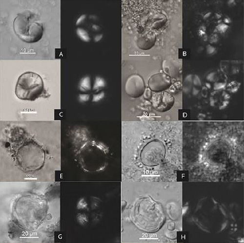 Microscopic traces of ancient starches extracted from the Raqefet Cave.