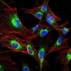 Image shows expression of NUCB2 in immune cells.