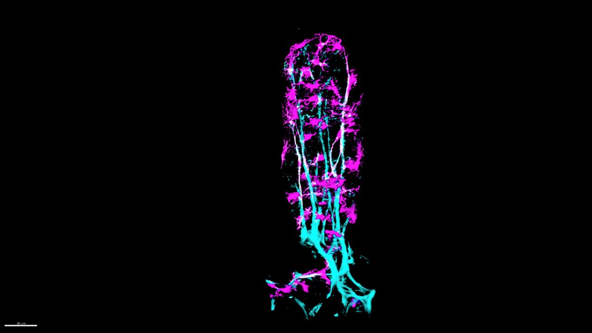 Gut Muscle Vital for Absorbing Fats Forms Like Scars