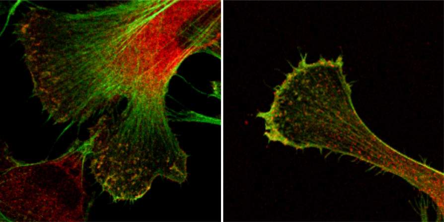 Researchers Discover How a Gene Only Some of Us Have May Protect Against Neurodegeneration