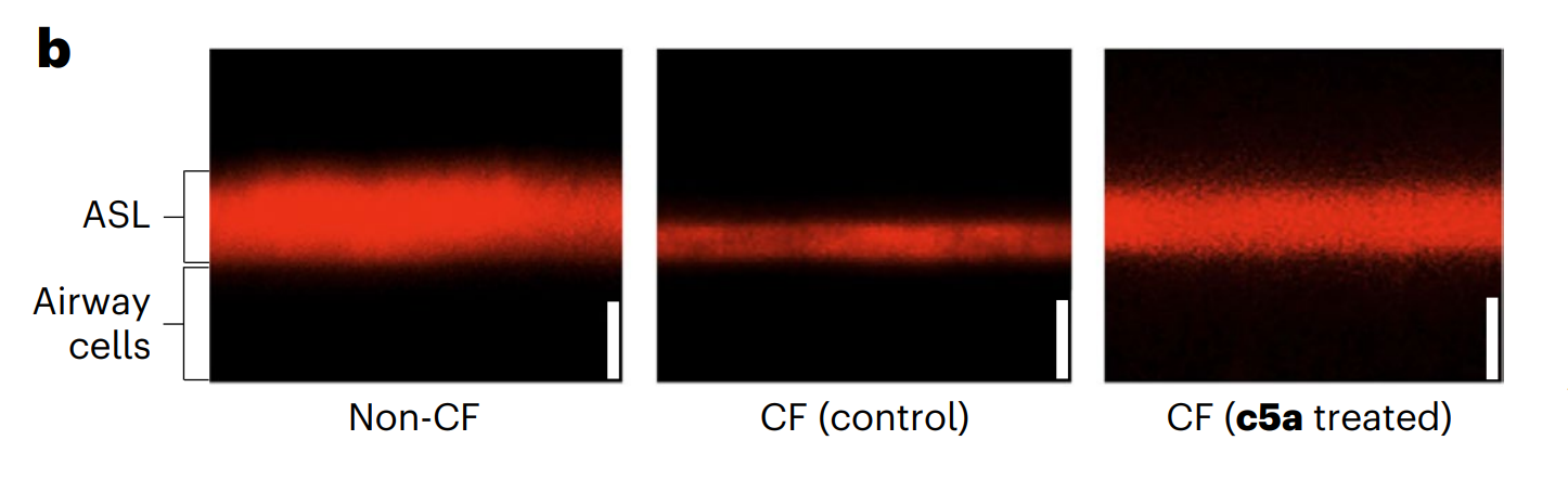 "Synthetic molecules can ‘ferry’ mucus-clearing ions blocked by cystic fibrosis"