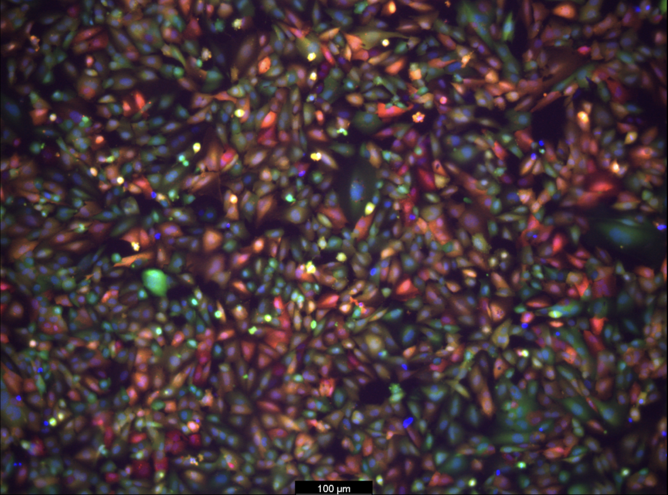 Bioengineers on the Brink of Breaching Blood-Brain Barrier