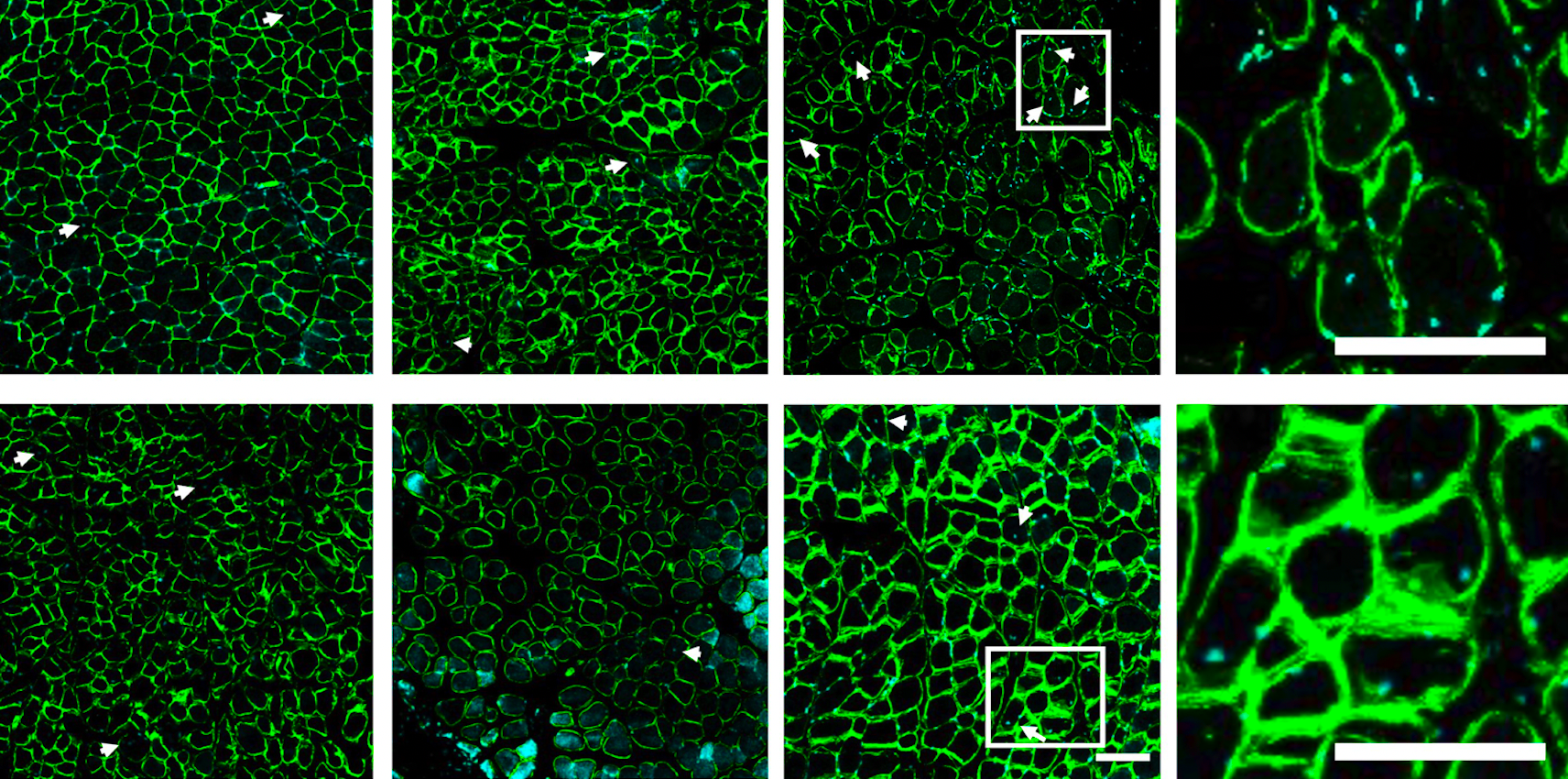 Two-Way Cell-based Treatment Repairs Muscle After Rotator Cuff Injury
