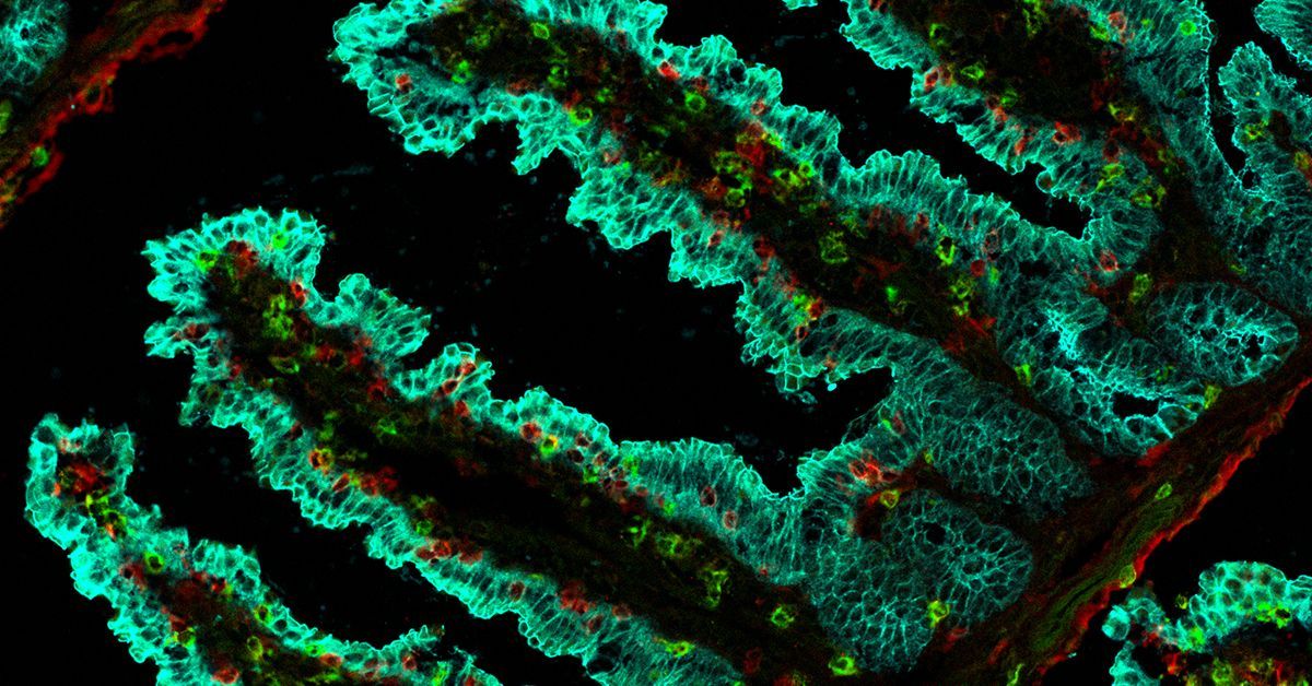 Enhancing Immune Defenses: Researchers Unveil the Secrets of Specialized T Cells to Conquer Tumors