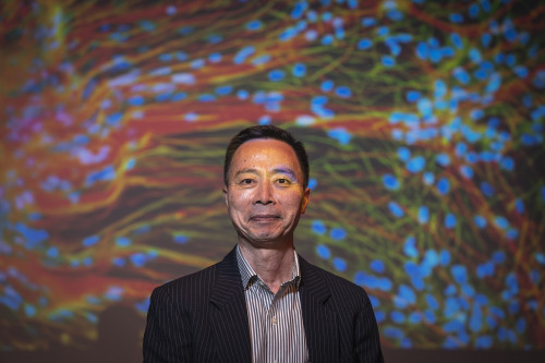 "UW–Madison Researchers First to 3D-Print Functional Human Brain Tissue"
