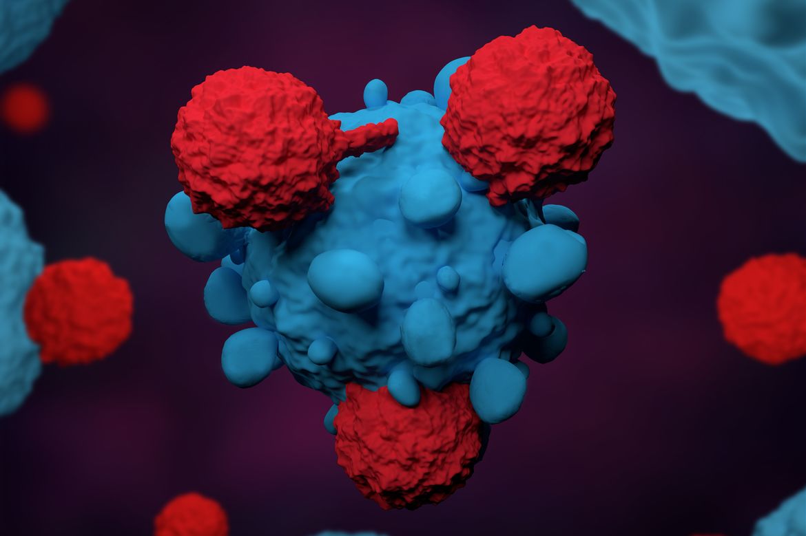 Immunotherapy Drug Combo Helps Extend Lives of People With Metastatic Melanoma