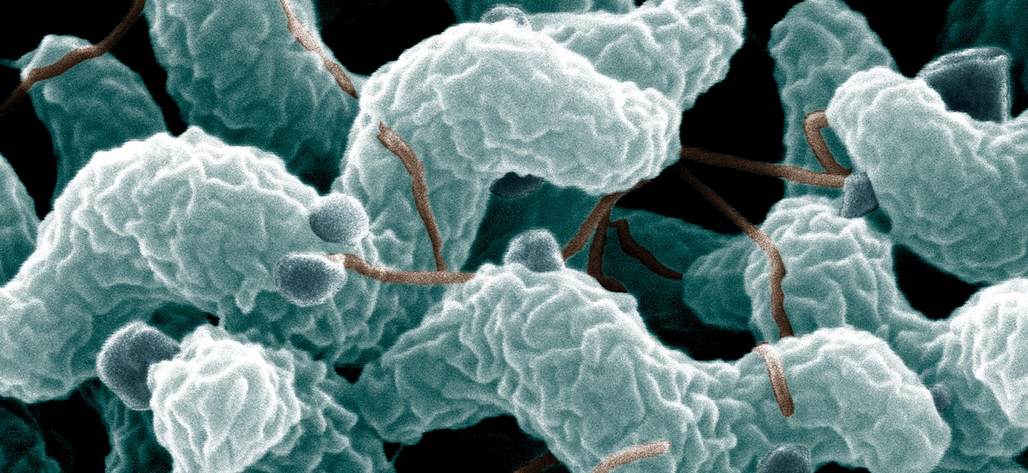 Foodborne illness is spreading antibiotic resistance