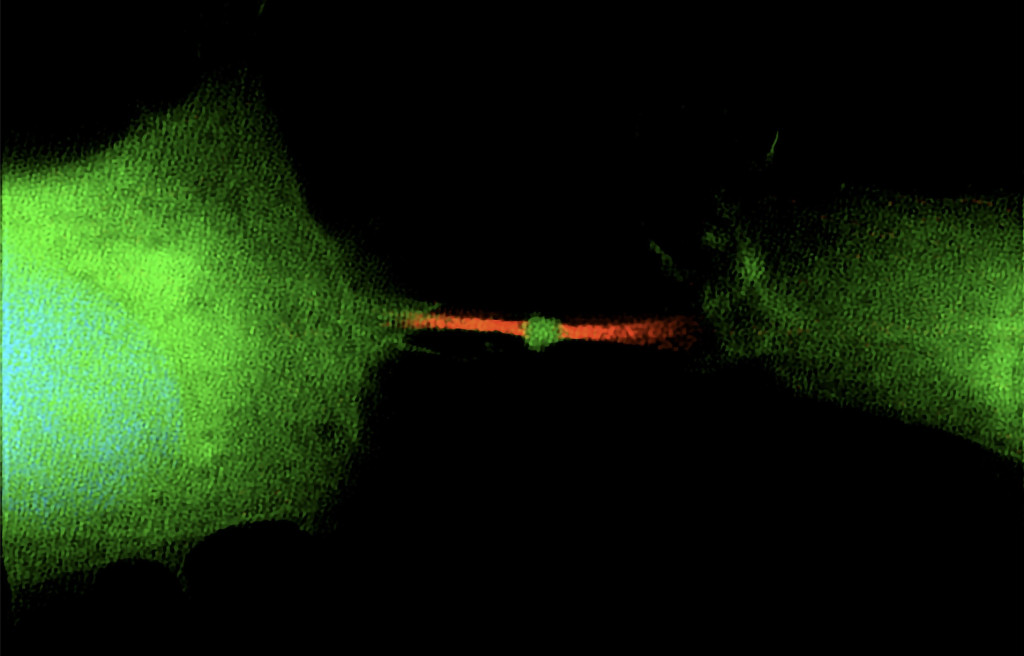 Remnant of Cell Division Could Be Responsible for Spreading Cancer