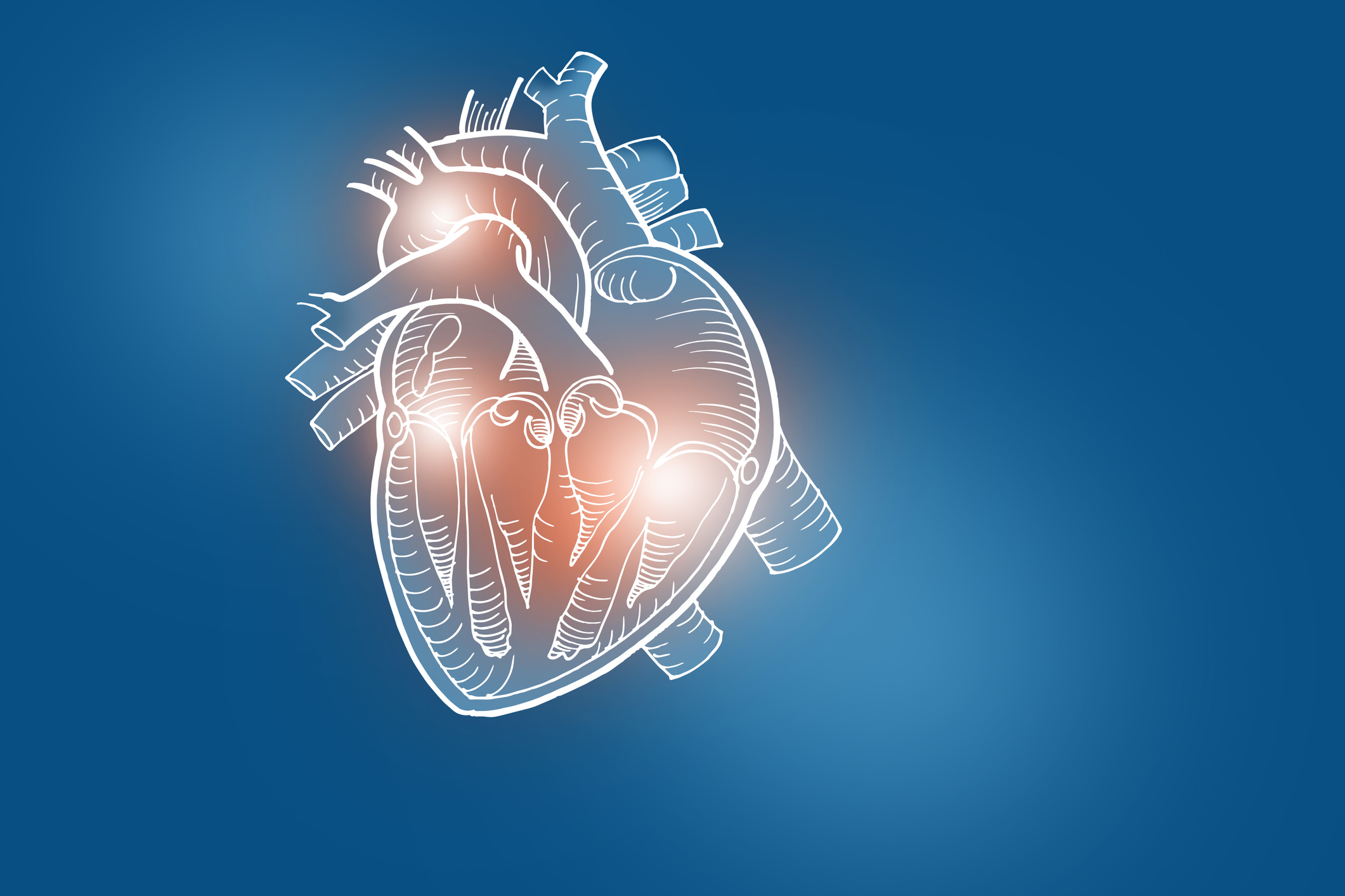 Handrawn illustration of human heart on dark blue background, First Ever Clinical Classification of Heart Attacks Based on Tissue Damage Adopted by Canadian Cardiovascular Society