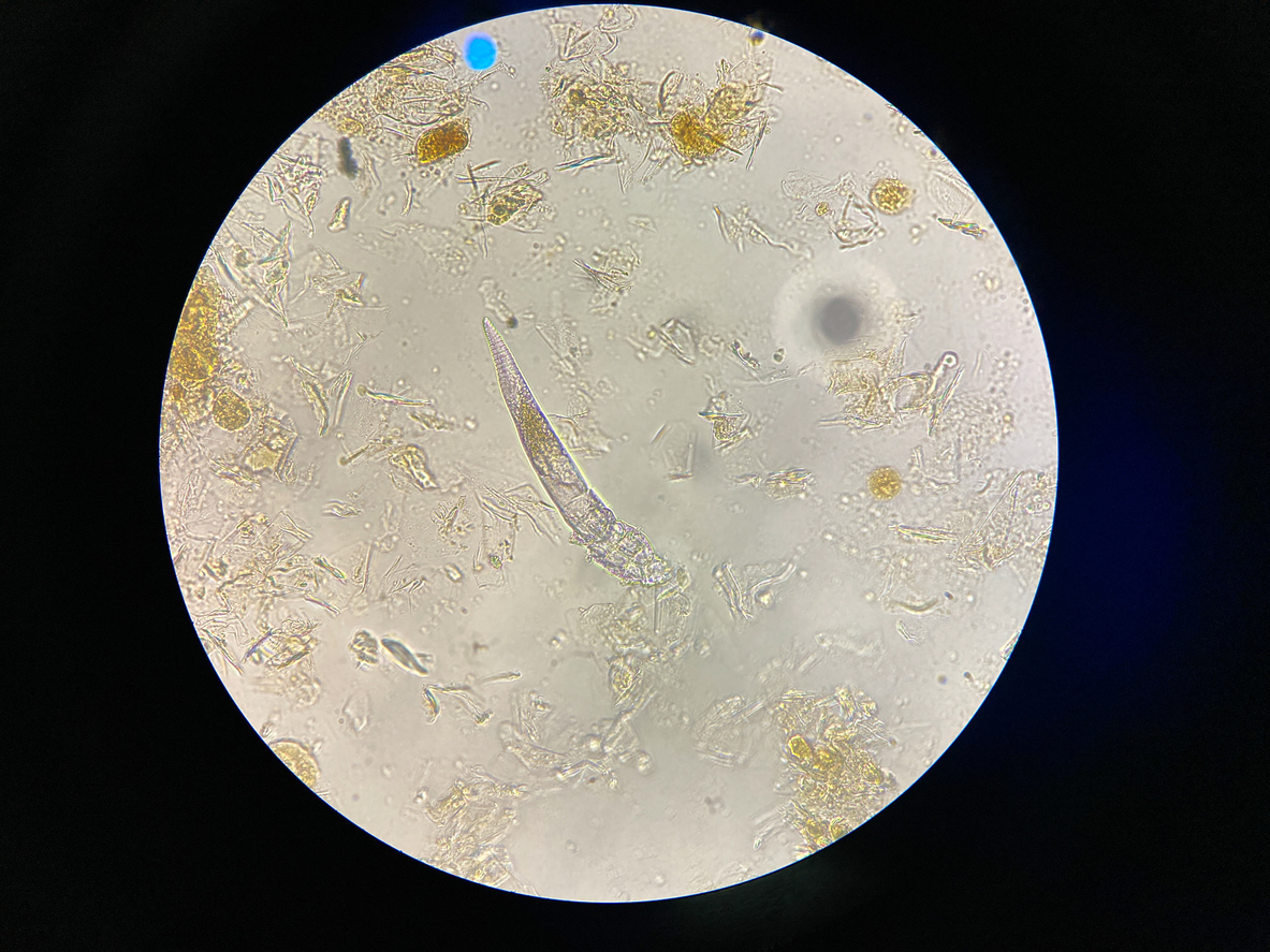 Newly Discovered Immune System Mechanism Suppresses Parasitic Infection