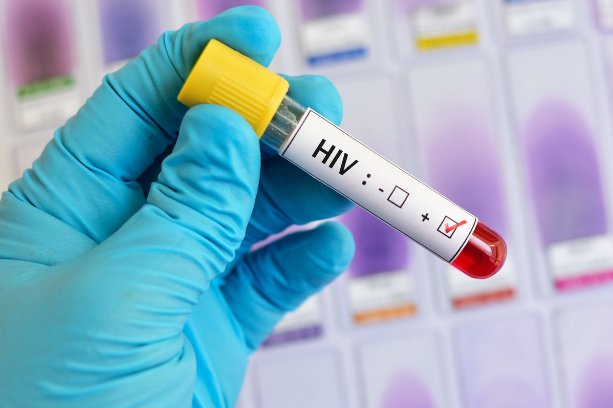 New HIV Therapy Reduces Virus, Boosts Immunity in Drug-Resistant Patients