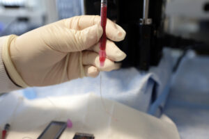 "Is Lung Cancer Treatment Working? This Chip Can Tell From a Blood Draw"