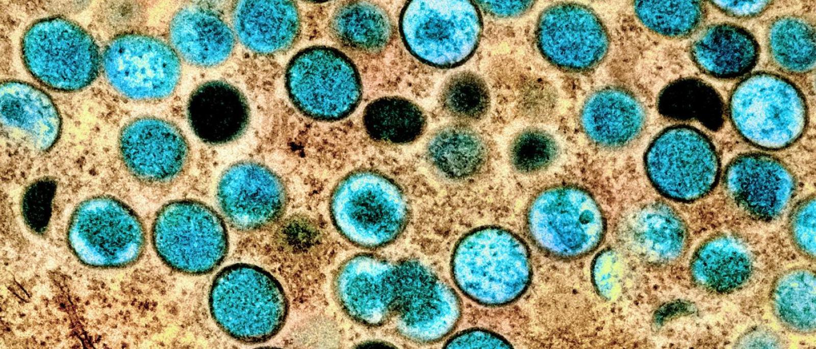 Mpox Antiviral Outcomes Are Similar Regardless of HIV Status