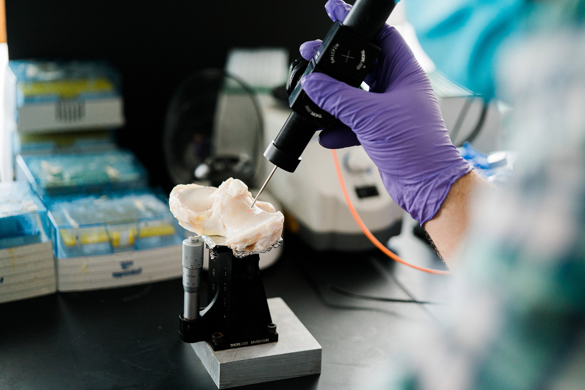 "New Noninvasive Light-Based Device Could Help Diagnose Osteoarthritis Early"