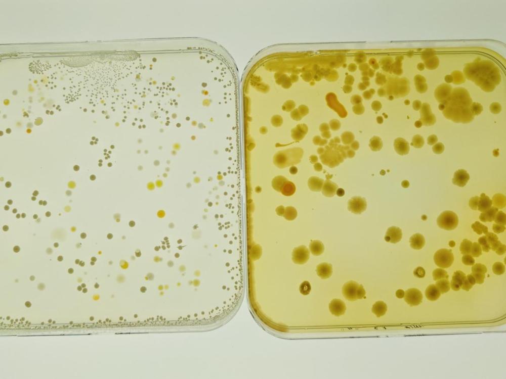 "Foodborne-Pathogen Listeria May Hide From Sanitizers in Biofilms"