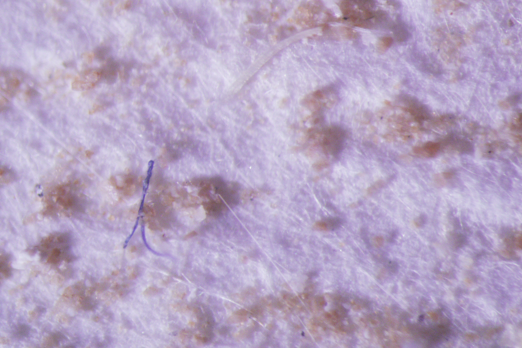 "Marine Lab Study Finds Microplastics Embedded in Tissues of Whales and Dolphins"