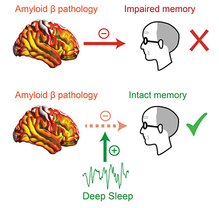 "Deep Sleep May Mitigate Alzheimer’s Memory Loss, Berkeley Research Shows"