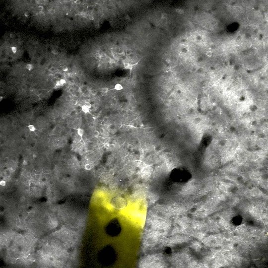 Two-photon microscopy image of a nanoelectrode (yellow) after two months implanted within the brain of a mouse, with healthy active neurons (bright regions) neighboring the implant. (Image courtesy of Rice Neuroengineering Initiative/Rice University)