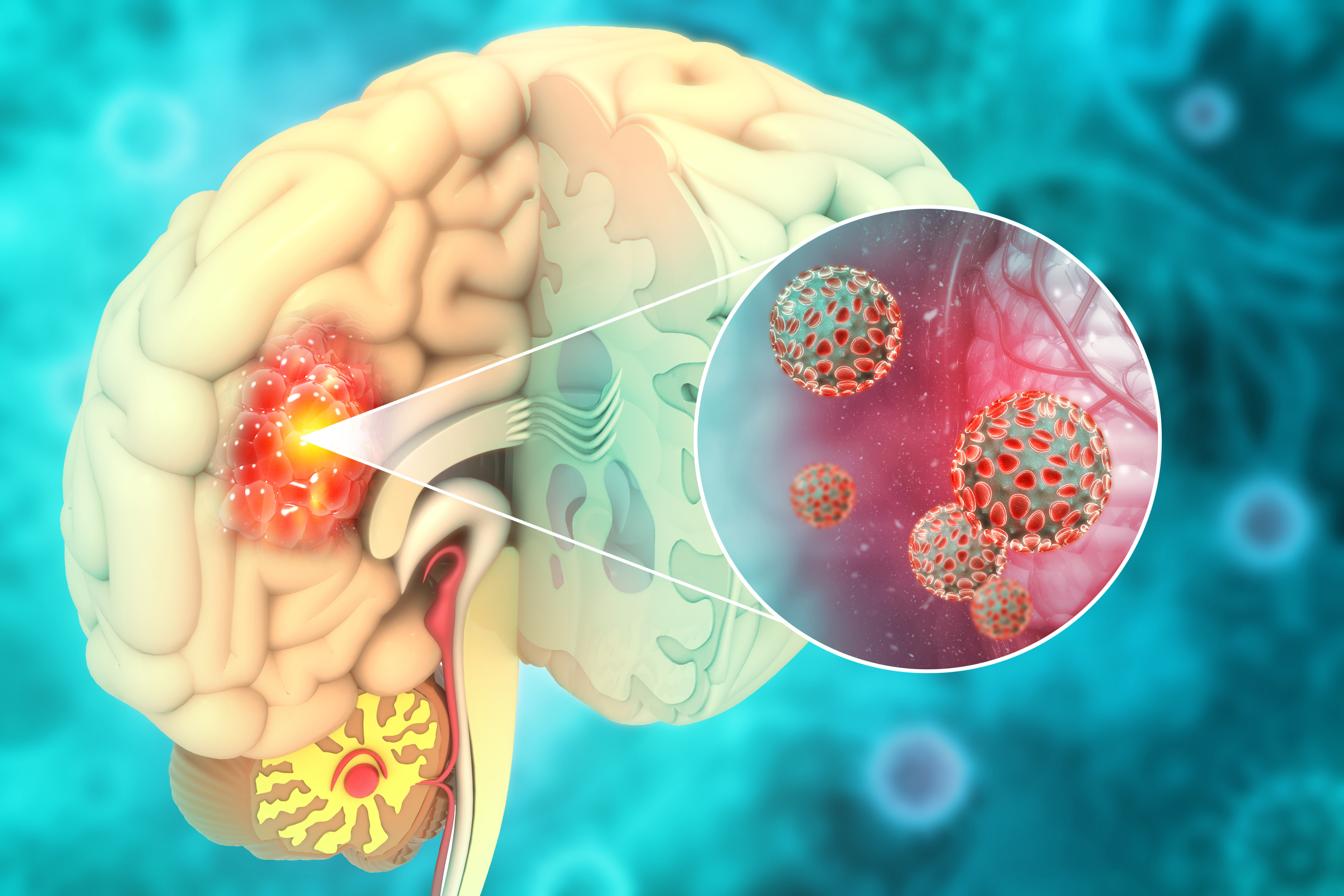Understanding Epigenetic Changes in Glial Cells May be Key to Combatting Brain Tumors