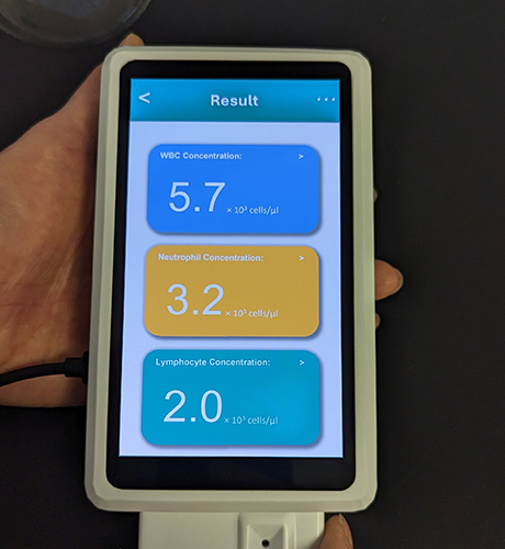 "Rutgers Researcher, Through Spinoff, Develops a Handheld White Blood Cell Tracker"