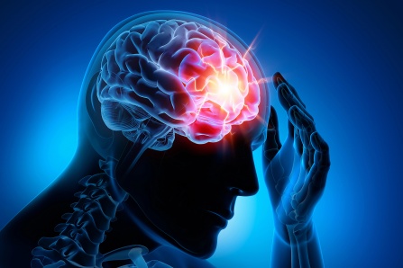 Headache, weakness, and seizures may be symptoms of chronic subdural hematomas, which become more common as we age. To treat them, patients undergo brain surgery, but hematomas can recur, requiring an additional surgery. The EMBOLISE clinical trial proves how it’s possible to sharply reduce the need for repeat surgeries.