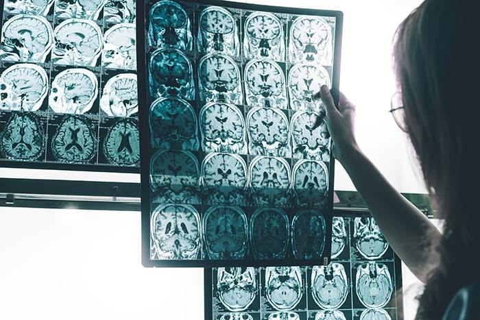 Photo of doctor looking at brain scans
