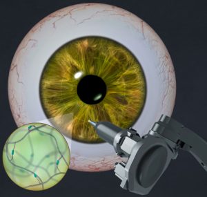 ucla-eye.jpg