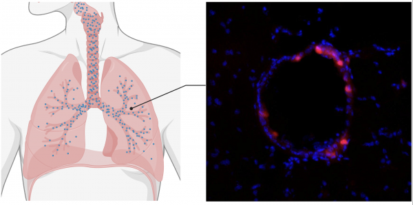 An mRNA COVID vaccine (and Potentially More) With Nanoparticles, No Shot Needed
