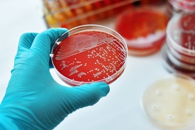 Bacteria culture in a petri dish