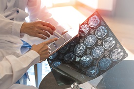 Brain Scans
