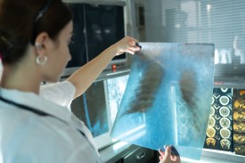 A woman analyzing an x-ray image of lungs