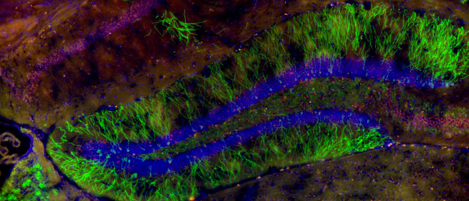 Baby Neurons in Adult Brains Are Needed to Maintain Memory