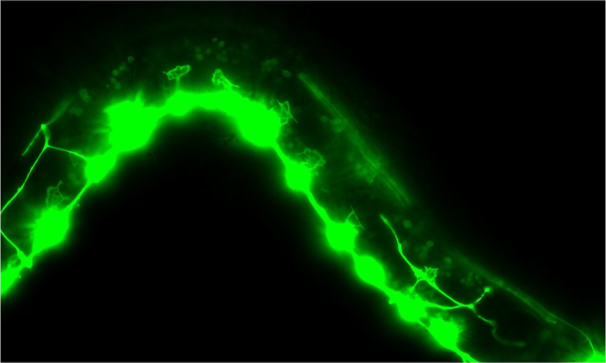 Study Reveals Same Genes That Can Drive Cancer Also Guide Neural-Circuit Growth