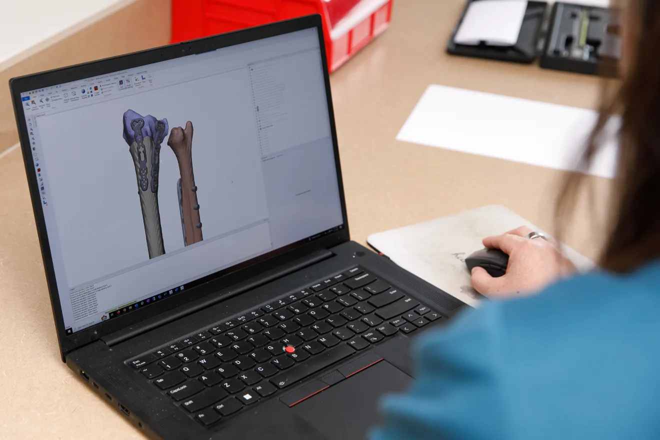 "Yale Begins 3D Orthopaedic Surgical Procedures That Are Fully In-house"