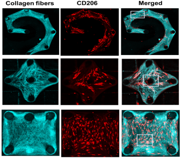 New Study Probes Macrophages’ Role in Developing Pulmonary Fibrosis