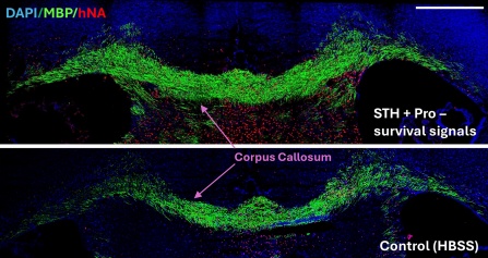 Most Stem Cells Die After Being Injected Into the Brain. This New Technique Could Change That.