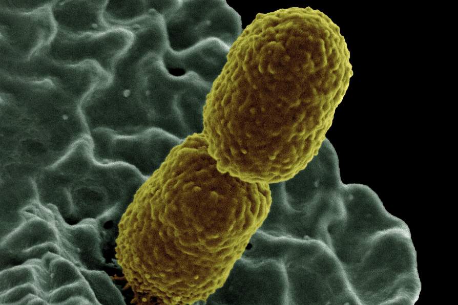 UB Research Identifies the Likely Culprit That Turns Classical Klebsiella Pneumoniae Into a Devastating, Drug-resistant Killer