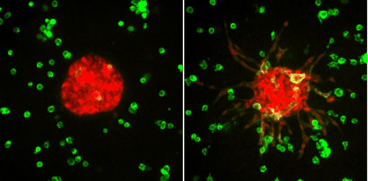 Tiny Tumor Model Recreates Cancer Metastasis