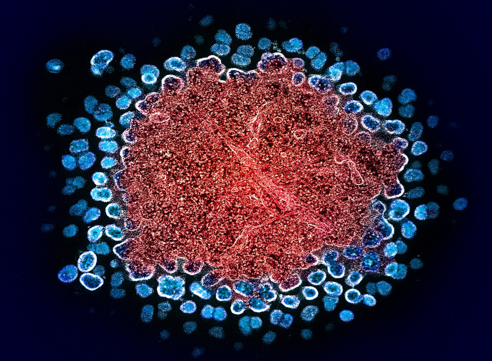 Study Confirms How RNA Chemical Modifications Benefit HIV-1