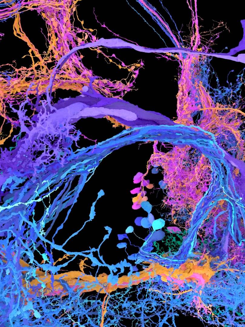 "Mapping an Entire (Fly) Brain: a Step Toward Understanding Diseases of the Human Brain"