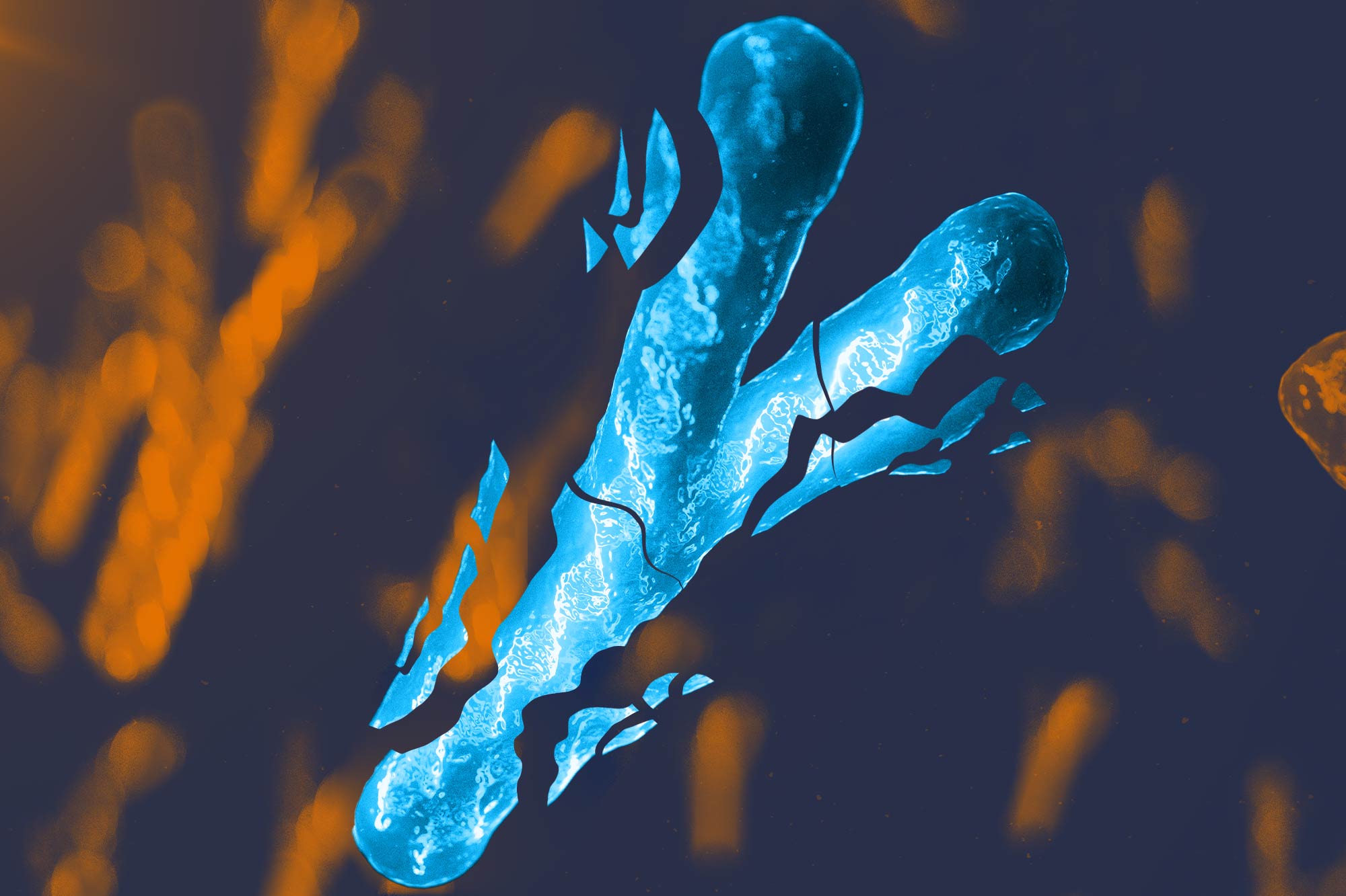 Understanding ‘Y’: Chromosome Discovery Advances Fight Against Heart Failure in Men