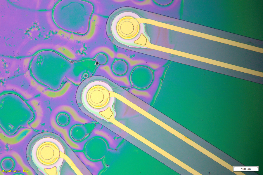 Ultrasound Offers a New Way to Perform Deep Brain Stimulation